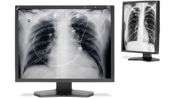 Display diagnostico per radiografie di casa NEC